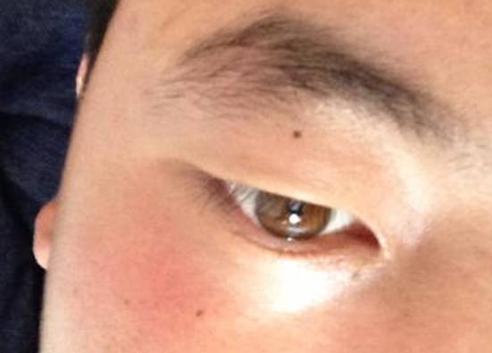 男人右眼皮长痣代表什么，代表感情运势不顺利